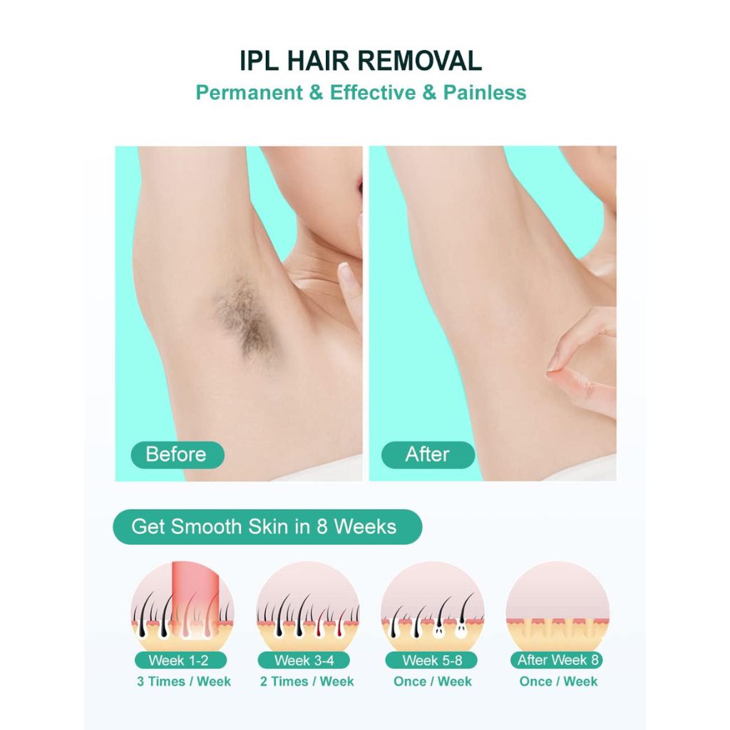 Auitroncar Depilacon IPL Laser para Mujeres y Hombres